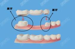 赤峰全瓷牙口腔醫(yī)院電話號(hào)碼
