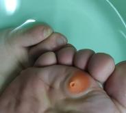 赤峰市修雞眼電話是多少號