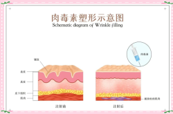 赤峰肉毒團購電話地址查詢