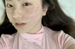 赤峰光子嫩膚上門電話號(hào)碼是多少