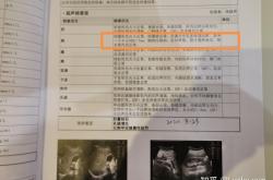 赤峰眾聯(lián)體檢中心電話號(hào)碼