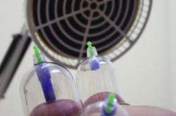 赤峰市中醫(yī)針灸診所電話號碼