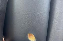 赤峰煙頭燙傷修復(fù)店電話號(hào)碼