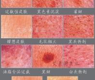 赤峰市皮膚檢測中心電話號(hào)碼