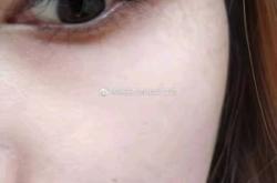 赤峰針劑醫(yī)美培訓(xùn)學(xué)校電話號(hào)碼