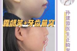 赤峰拔牙矯正醫(yī)院電話是多少號