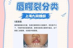 赤峰兔唇理發(fā)師電話地址查詢