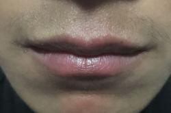 赤峰胡須清理中心地址電話號碼