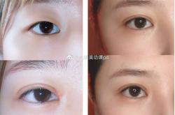 赤峰眉釘穿孔醫(yī)生名單電話號碼