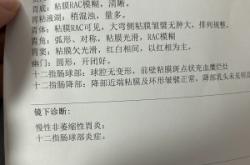 赤峰市預(yù)約胃鏡醫(yī)院電話號(hào)碼