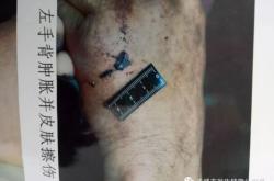 赤峰法醫(yī)鑒定平臺電話號碼