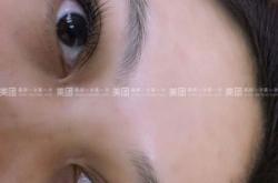 赤峰睫毛嫁接團(tuán)購群電話號碼