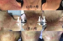 赤峰汽車地毯燙傷修復(fù)電話號(hào)碼