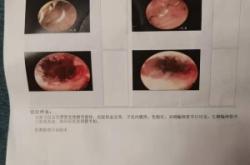 赤峰平民醫(yī)院咨詢電話號(hào)碼是多少