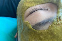 赤峰祛疣祛痘醫(yī)院電話號(hào)碼