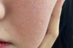 赤峰清潔毛孔團(tuán)購(gòu)地址電話(huà)號(hào)碼