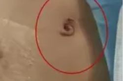 赤峰市小兒外科醫(yī)院電話號(hào)碼