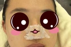 赤峰清潔黑頭團(tuán)購(gòu)電話地址是多少