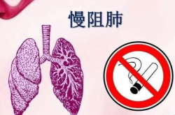 赤峰礦區(qū)總醫(yī)院官網(wǎng)電話(huà)號(hào)碼