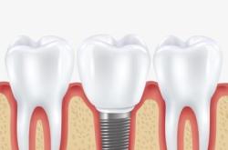 赤峰種牙推薦醫(yī)生電話是多少號(hào)