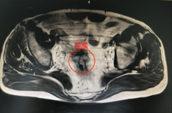赤峰市醫(yī)院肛門科電話號(hào)碼