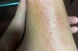 赤峰水泡子轉(zhuǎn)租電話多少號