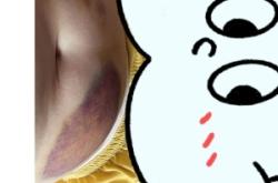 赤峰市婦產(chǎn)醫(yī)院抽血電話號(hào)碼