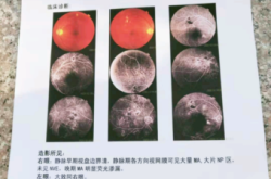 赤峰市醫(yī)院眼科電話號碼是多少