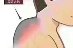 赤峰新城肩頸疏通店電話號碼