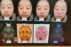 赤峰美容團(tuán)購水光針電話號(hào)碼