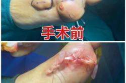 赤峰痛風(fēng)康復(fù)中心電話多少號(hào)