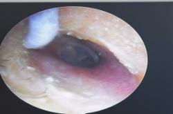 赤峰首耳采耳店電話地址查詢