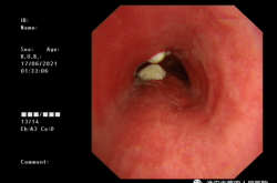 赤峰市支氣管鏡醫(yī)院電話號碼