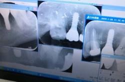 赤峰錦美口腔連鎖電話多少號