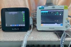 赤峰數(shù)碼印刷機(jī)電話多少號(hào)