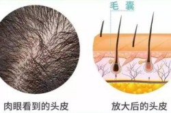 赤峰拔白頭發(fā)店電話地址查詢