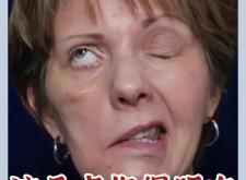 赤峰肉毒團(tuán)購電話地址查詢