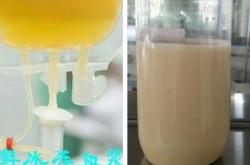 赤峰市醫(yī)院血漿機采購電話號碼