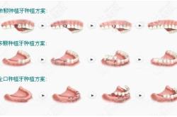 赤峰瑞美口腔醫(yī)院電話地址查詢