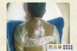 赤峰熱灸膏廠(chǎng)家電話(huà)號(hào)碼