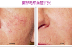 赤峰全身美白醫(yī)院電話號(hào)碼是多少