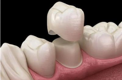 赤峰回收氧化鋯電話地址查詢