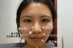 赤峰美容達人名單電話是多少號