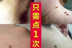 赤峰無痕修復(fù)旗艦店電話號碼