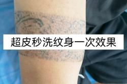 赤峰超皮秒紋身店地址電話號(hào)碼