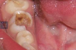 赤峰口腔醫(yī)學(xué)院地址電話號碼