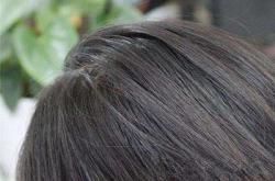 赤峰拔白發(fā)店電話號碼多少啊