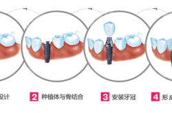 赤峰附院大學(xué)口腔科電話號碼