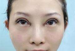 赤峰錦然雙眼皮店電話號(hào)碼