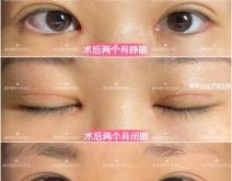 赤峰切眉美容院地址電話號碼